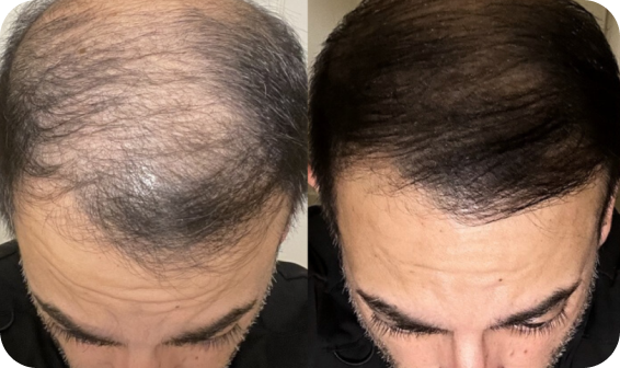 Avis client RedgenR